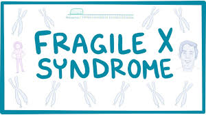 Fragile X is a mutation on the X chromosome.